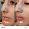 Lucim+™ Lip Plumping Gloss - Image 4