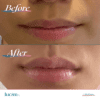 Lucim+™ Lip Plumping Gloss - Image 3